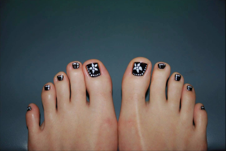 Elegant Black Pedicure Design