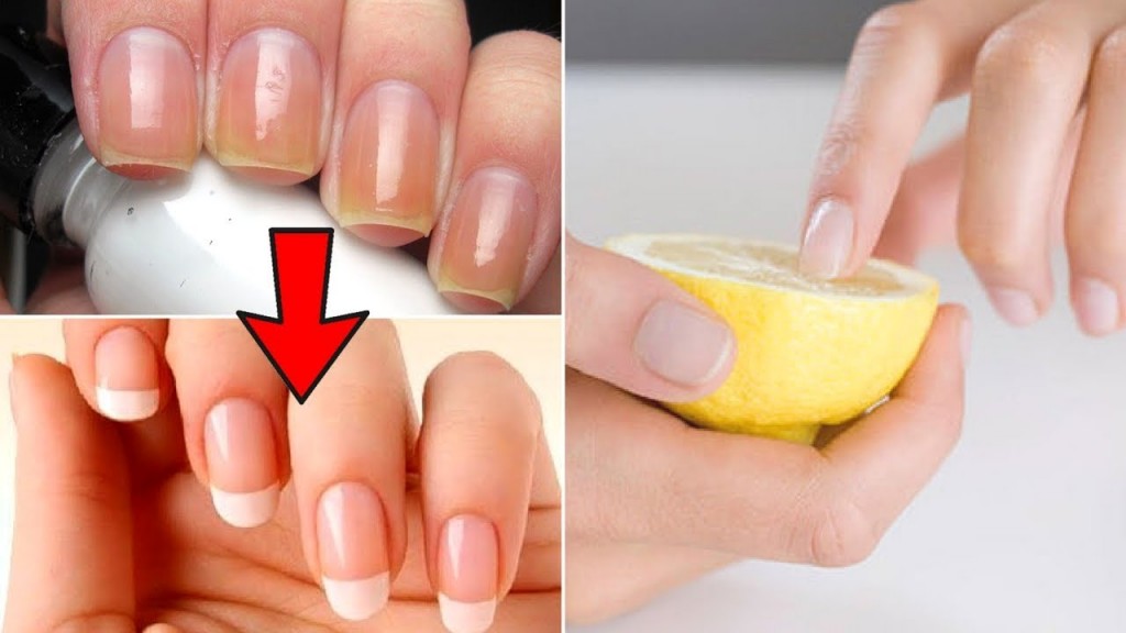 How to Get Rid of Yellow Nails by Home Remedies